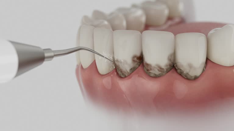 Trusted Dental Crowns And Bridges service in Texanna, OK - Dentist Open Now